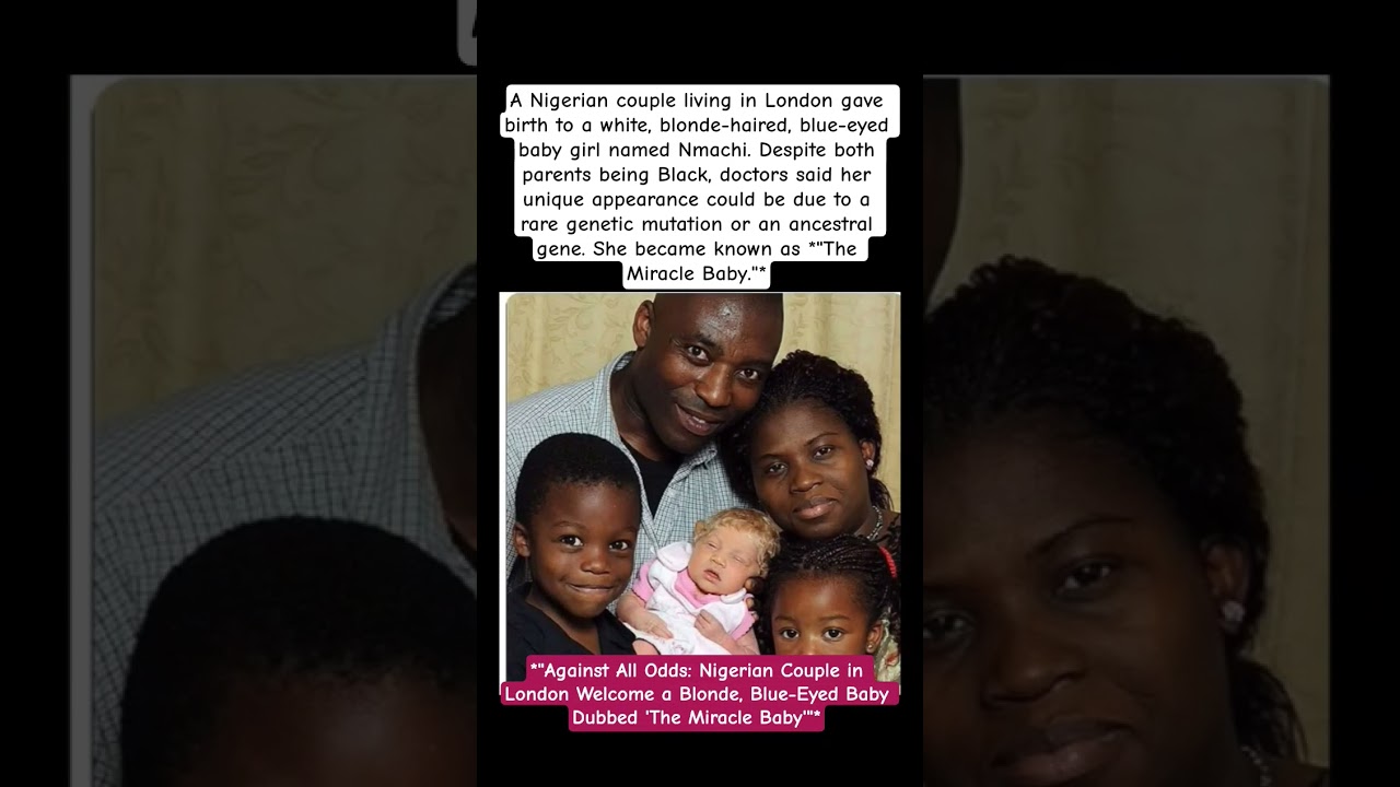 Nigerian Couple in London Welcome a Blonde, Blue-Eyed Baby Dubbed 'The Miracle Baby#shorts