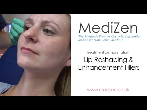 Learn about Lip Enhancement & Reshaping Fillers