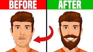 How to Deal With a Patchy Beard