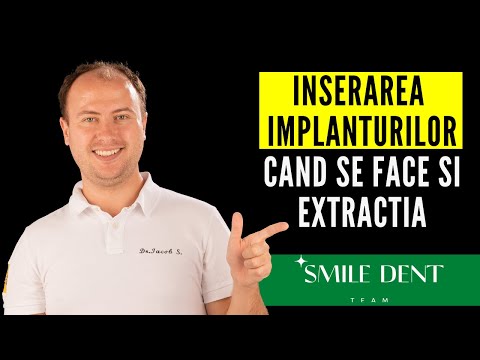 Implantarea în aceeași zi când se face extracția ● Întrebări și Răspunsuri cu Dr. Iacob Surchicean