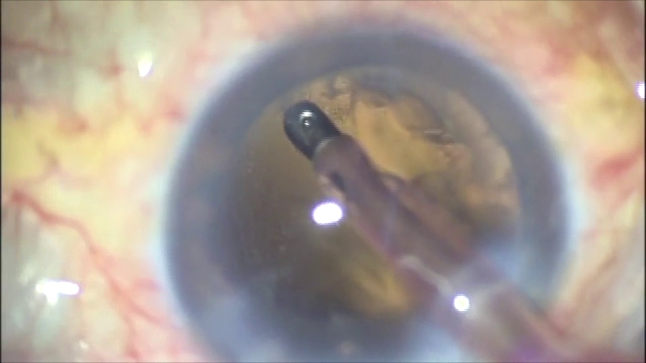 Alejandro Silva Moreno-10