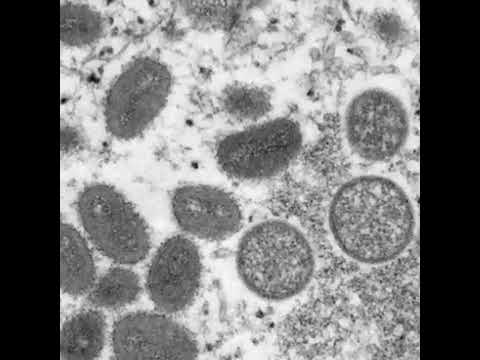 There’s another virus to watch out for in Montreal