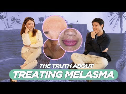 Beste Behandlungsmethode für Melasma/Pekas? Dermatologe antwortet und erklärt! (Philippinisch) | ...