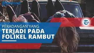 Folikulitis, Kondisi yang Ditandai dengan Peradangan pada Folikel Rambut
