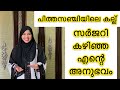 പിത്തസഞ്ചി ഒഴിവാക്കിയ എന്റെ അനുഭവം |Gallblader stone|Lapar