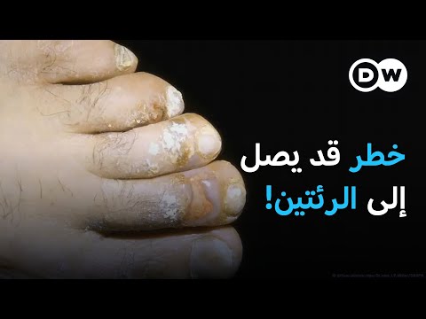 هل تعلم أن بذور اليقطين ليست مجرد وجبة خفيفة لذيذة، بل هي كنز مليء بالفوائد الصحية؟ اكتشف كيف تعزز صحة القلب و الهضم. وإليك طرق سهلة لتضمينها في نظامك الغذائي 