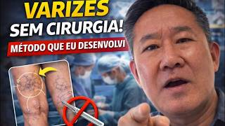 COMO TRATAR VARIZES SEM CIRURGIA (MÉTODO QUE EU DESENVOLVI) | Peter Liu
