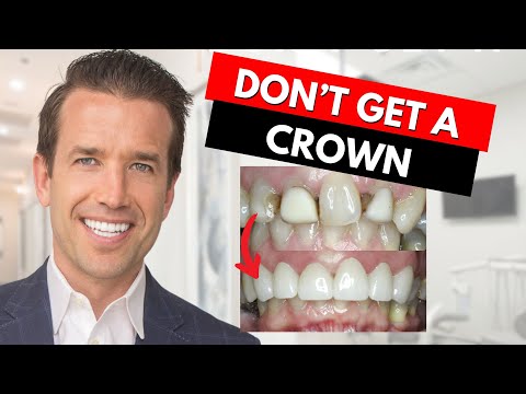 Watch this before getting a Dental Crown!