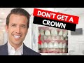 Watch this before getting a Dental Crown!