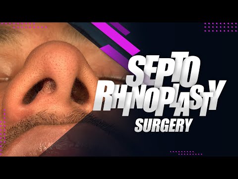 Video Of The Combination Surgery