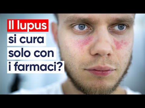Systemic lupus erythematosus: what it is, symptoms, and treatment