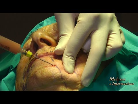 Mettere la patata rozza a occhi da borse Maschere per ringiovanimento di faccia efficace