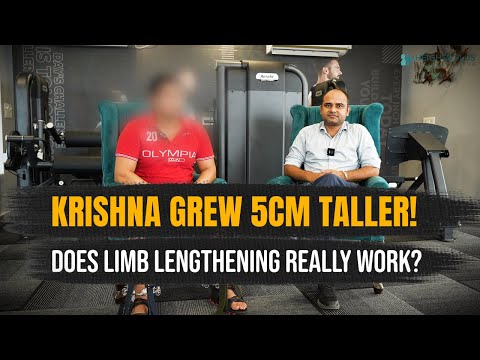 Honest Patient Story: Krishna Gained 5cm+ with Limb Lengthening at Heights Plus