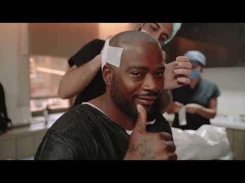 Premium Hair Transplant in Turkey