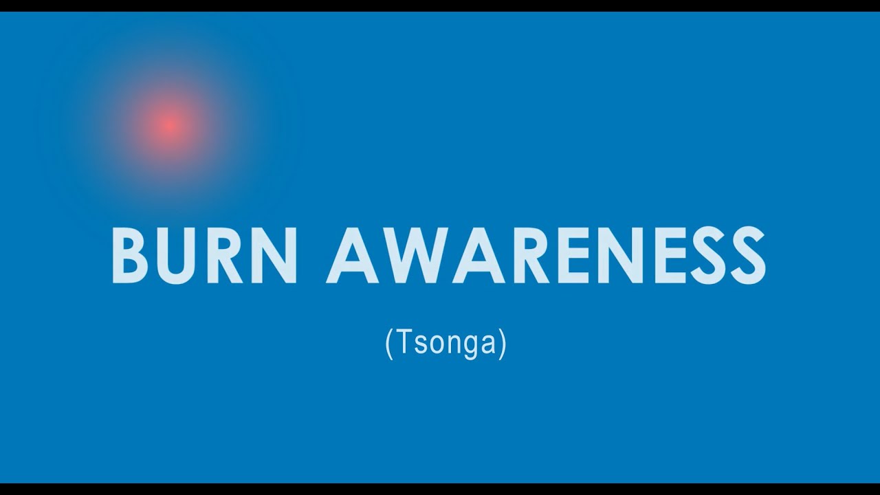 Burn Awareness (Tsonga)