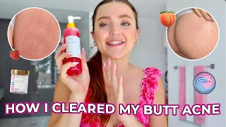 The TRUTH About How I Fixed My Butt Acne | My Experience with Truly Beauty!