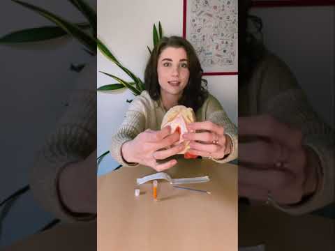 Vaginaler Abstrich und Analer Abstrich