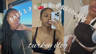 COME TO TURKEY WITH ME ! BREAST AUGUMENTATION VLOG | DAYS 1-7