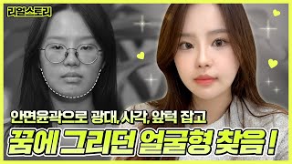 윤곽3종수술 리얼 언박싱, 대학생 성형스토리이야기 ^^