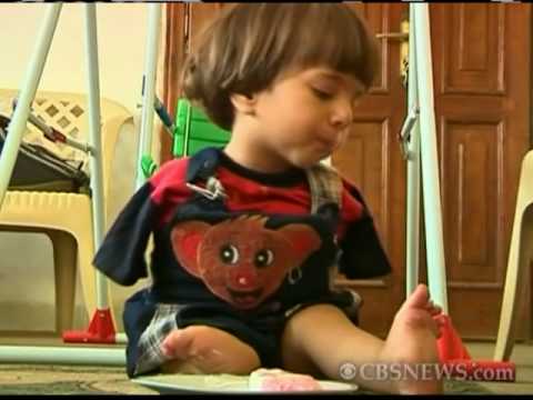 Boy Without Arms Overcomes Obstacles