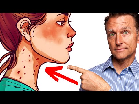 如果出現這 7 個令人意外的跡象，表示你吃太多糖啦！ (7 Signs You're Eating Too Much Sugar)