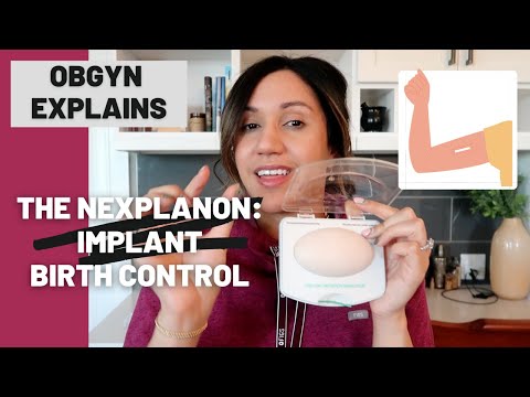 Implant Birth Control: Everything you NEED to know about the Nexplanon