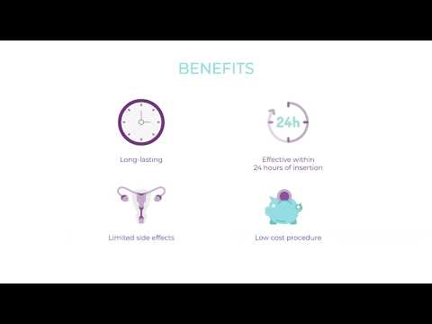 What are Levoplant™ implants, one of the most effective contraception available. (English version)