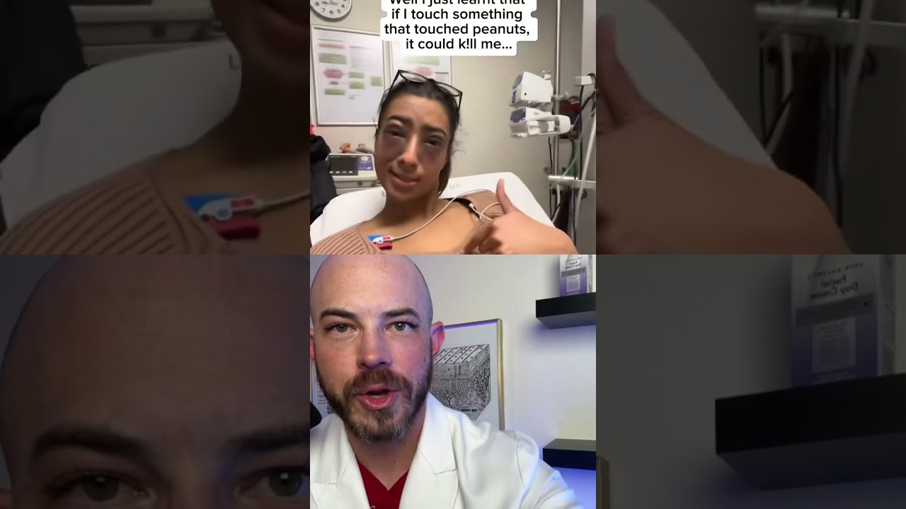 Derm reacts to peanut allergy! #doctorreacts #dermreacts
