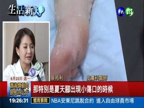 消毒水太"毒"?! 幼童脫皮皮膚炎