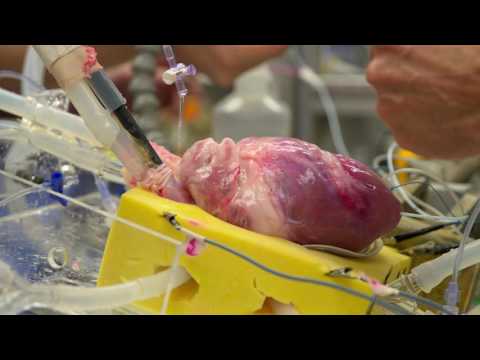 download lagu mp3 mp4 Poppers Heart Attack, download lagu Poppers Heart Attack gratis, unduh video klip Poppers Heart Attack