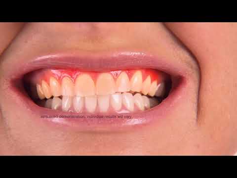 Why Intelliwhite is Better Animation