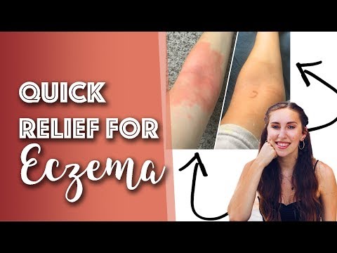 Lava a eczema della pelle principale Ureaplasma a dermatite atopic