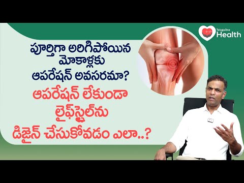 Knee Surgery | పూర్తిగా అరిగిపోయిన మోకాళ్లకు ఆపరేషన్ అవసరమా? Dr. K. Sudhir Reddy | TeluguOne Health