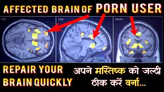 Nobody Tells You to Repair Affected Brain After Porn Addicted - दिमाग से पोर्न जल्द आज ही  निकालें !