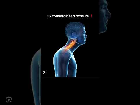 How to fix forward head posture (nerd neck)