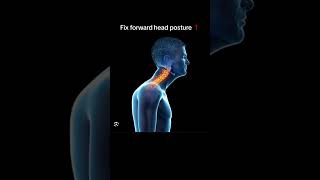How to fix forward head posture (nerd neck)