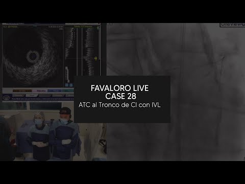 Favaloro Live Case N° 28 - ATC al Tronco de CI con IVL