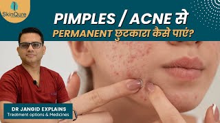 How to get rid of Acne/Pimples | Treatment Options & Medications | Dr. Jangid