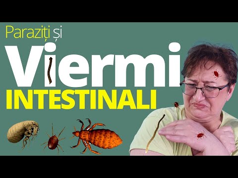 11 simptome de VIERMI INTESTINALI + 5 urmari GRAVE