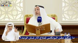 75- ما حكم حقن البوتكس لعلاج آثار شلل الوجه؟ - عثمان الخميس