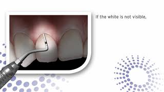 Instrument Sterilization: Optimize Your Workflow