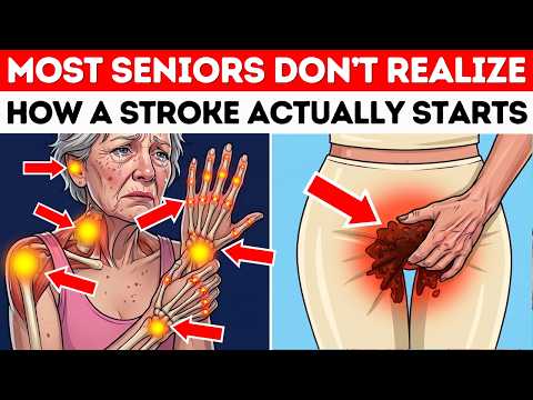 SENIORS! What a Stroke Looks Like the Day Before It Hits (Most Miss #4)