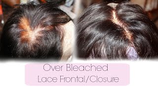 Color Correct Over Bleached Lace Frontal / Closure