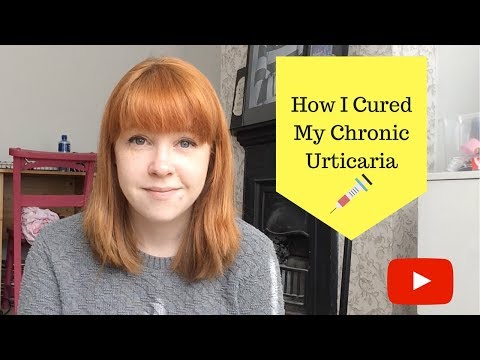 How I cured my Chronic Urticaria