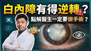 [白內障] 點解醫生一定要你做手術 ? | 如果白內障有得逆轉，你做唔做手術呢 ? | 日本解晶科技「咪唑環」為白內障帶來新轉機 ?