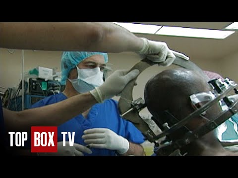 Brain Surgeon Removes Tumor - The Surgeons - Dr. Mark Bernstein