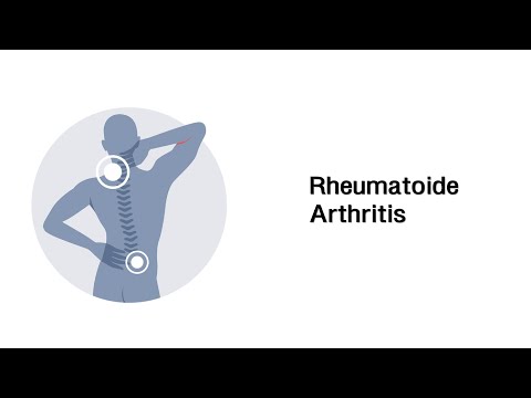 Rumänischer Druck wund untere Rücken Schmerz im linken Hoden Osteochondrose