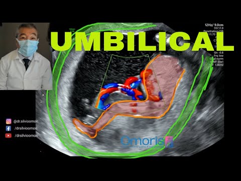 CORD CONFUNDS GENITALIA? - 14 weeks