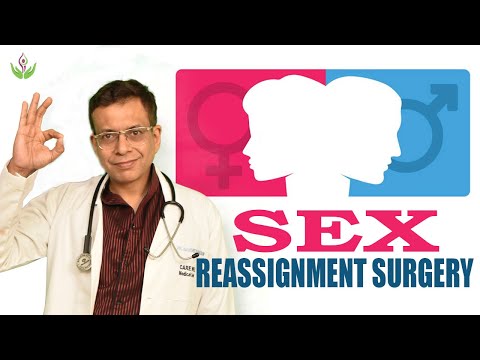 Gender Change Surgery (Male to Female) का पूरा प्रोसेस और खर्चा? 🏳️‍⚧️ मरीज़ का अनुभव जानिए!