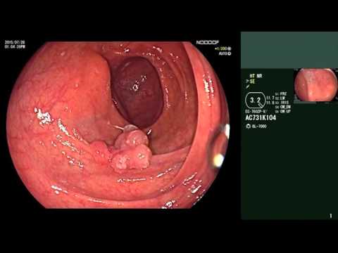 Behandlung von Prostatitis Heiler Alle Geräte für die Behandlung von Prostatitis